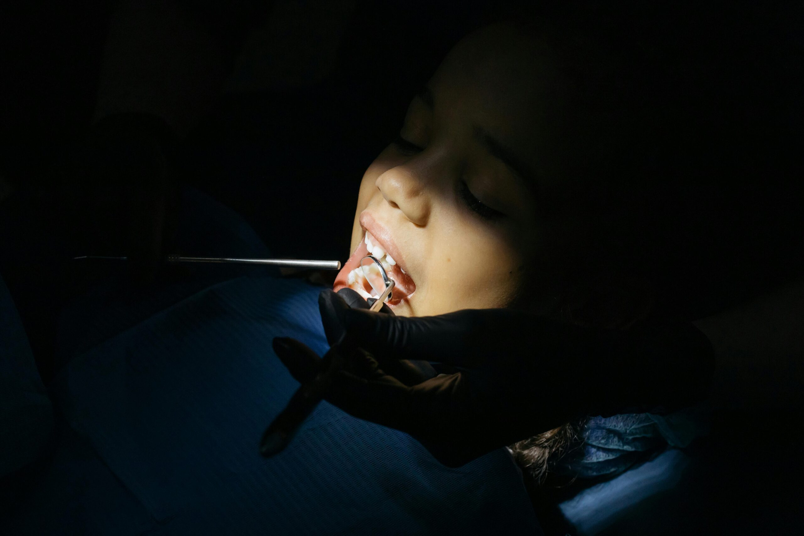 Dental Care Crisis in California: Latino Children Struggle to Access Basic Services